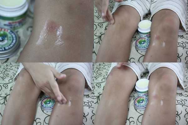 NATURKEY力萃奇旺福金安膏