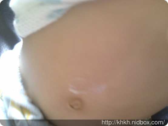 NATURKEY力萃奇旺福金安膏