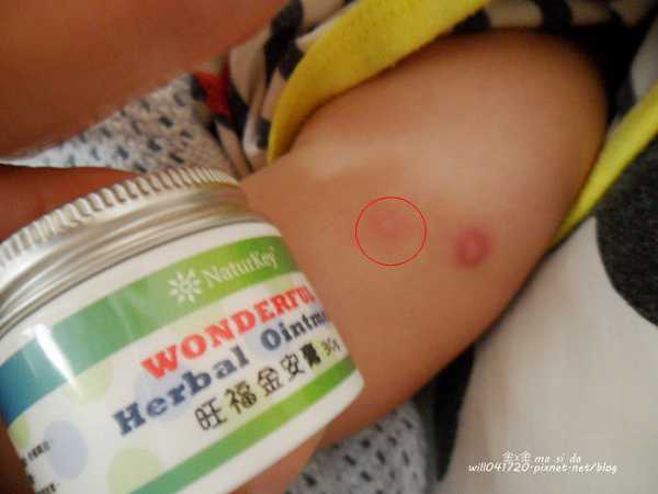 NATURKEY力萃奇旺福金安膏