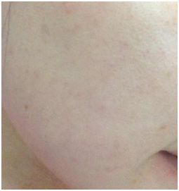 yadoma水母膠原賦活精華乳