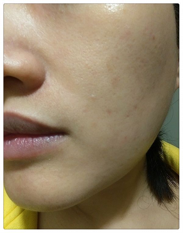 yadoma水母膠原賦活精華乳