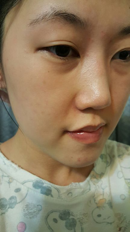 yadoma水母膠原賦活精華乳