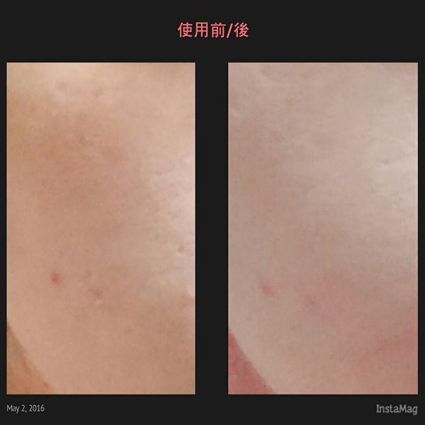 yadoma水母膠原賦活精華乳