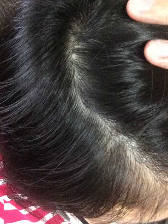 GaGa摩洛哥5.5頭皮專科舒緩洗髮精