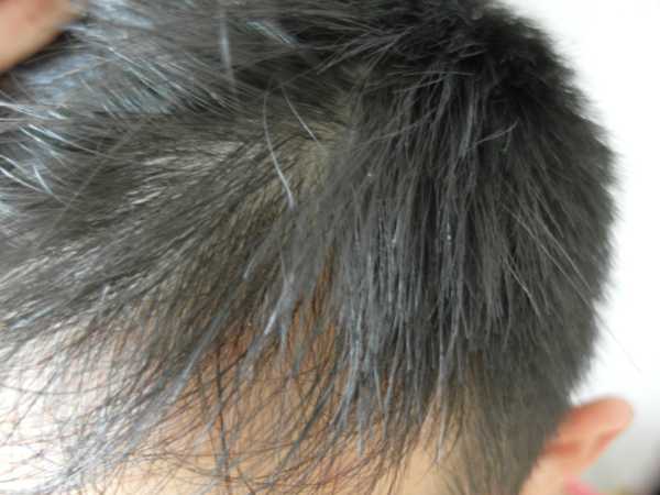 GaGa摩洛哥5.5頭皮專科舒緩洗髮精