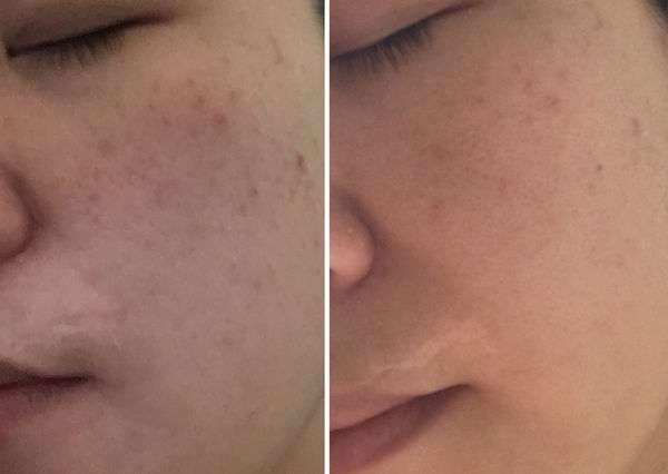 露奇亞白松露煥顏乳霜面膜