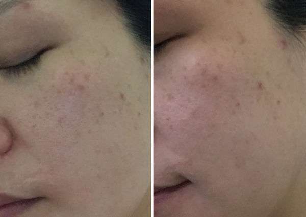 露奇亞白松露煥顏乳霜面膜