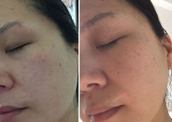 露奇亞白松露煥顏乳霜面膜