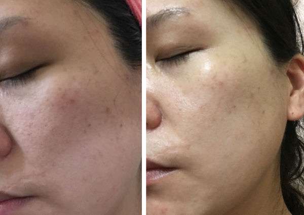 露奇亞白松露煥顏乳霜面膜