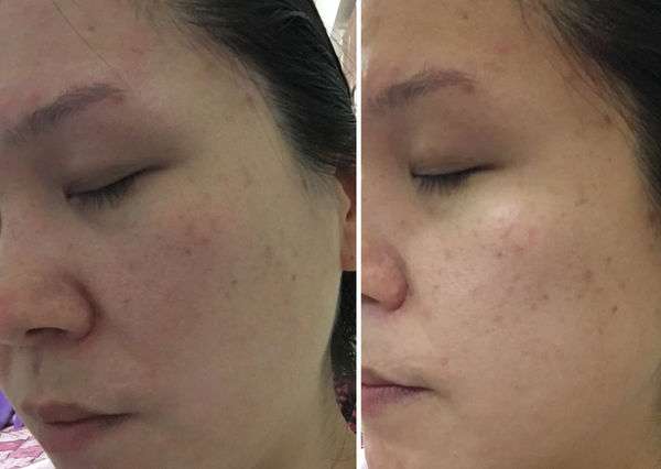 O'CODE閃光肌微晶絲