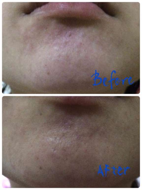 O'CODE閃光肌微晶絲