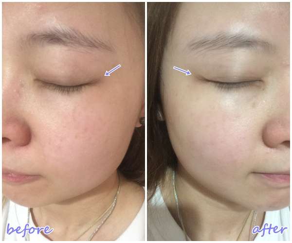 碧荷柏童顏肌密賦活精萃