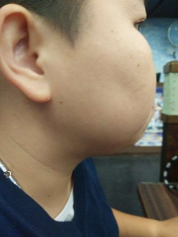 碧荷柏童顏肌密賦活精萃