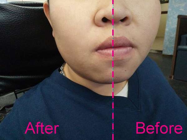 碧荷柏童顏肌密賦活精萃