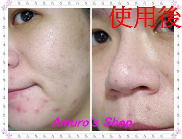 AMIINO安美諾毛孔緊緻鎖水精靈