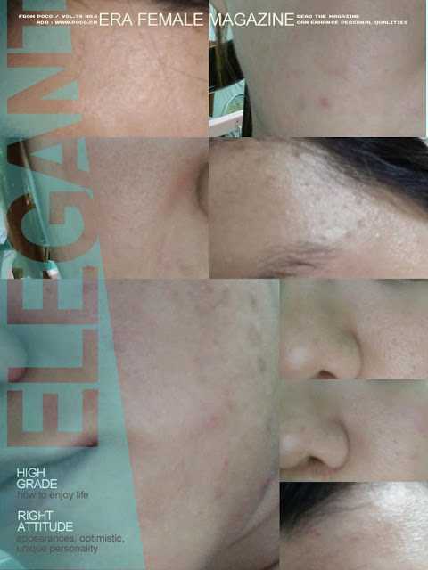 AMIINO安美諾毛孔緊緻鎖水精靈