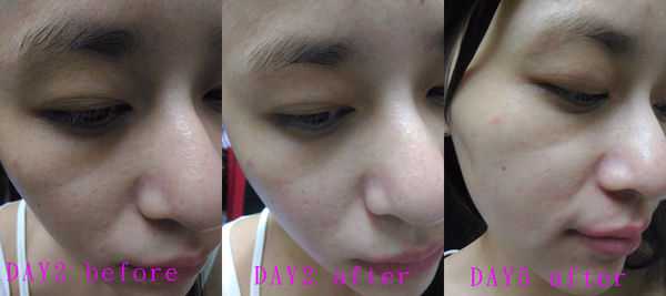 AMIINO安美諾毛孔緊緻鎖水精靈