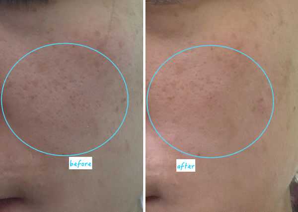 AMIINO安美諾毛孔緊緻鎖水精靈