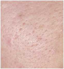 AMIINO安美諾毛孔緊緻鎖水精靈