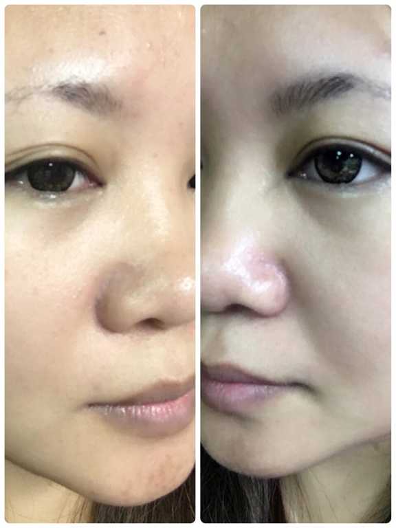 AMIINO安美諾毛孔緊緻鎖水精靈