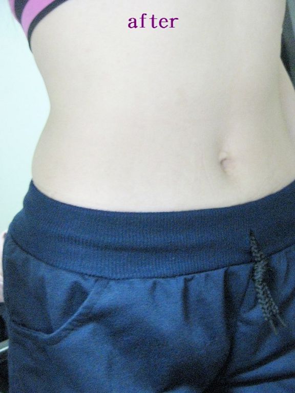 大合暢酵素益生菌