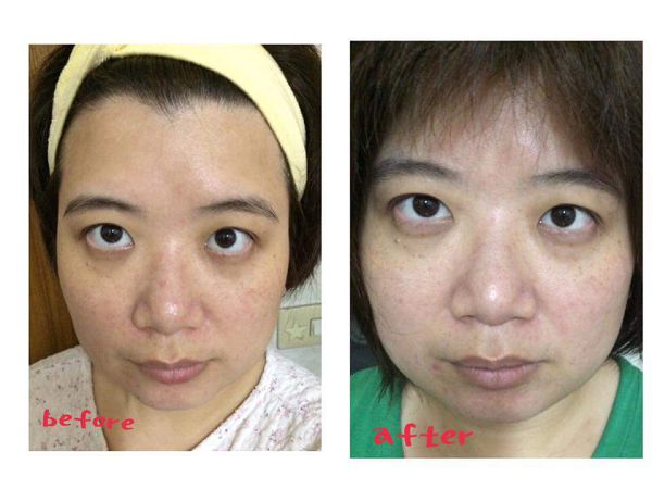 Derma彈力賦活霜