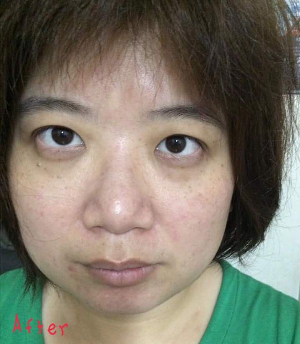 Derma彈力賦活霜