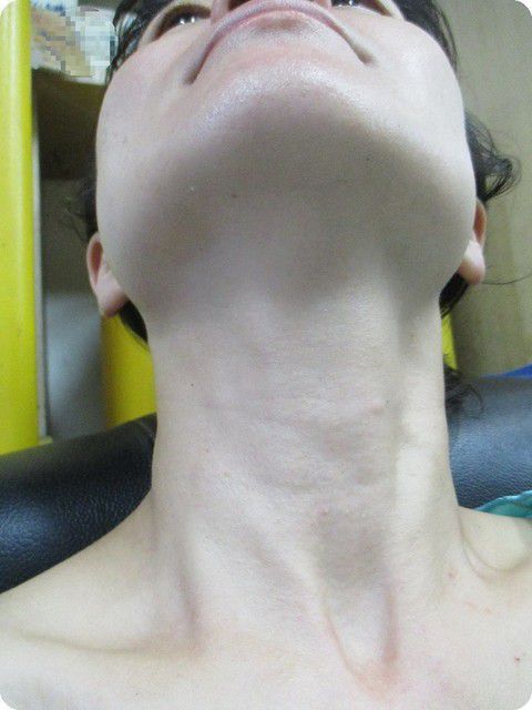 Derma彈力賦活霜