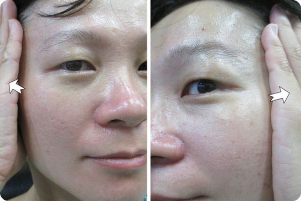 Derma彈力賦活霜