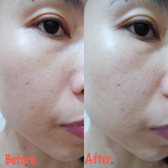 Derma彈力賦活霜