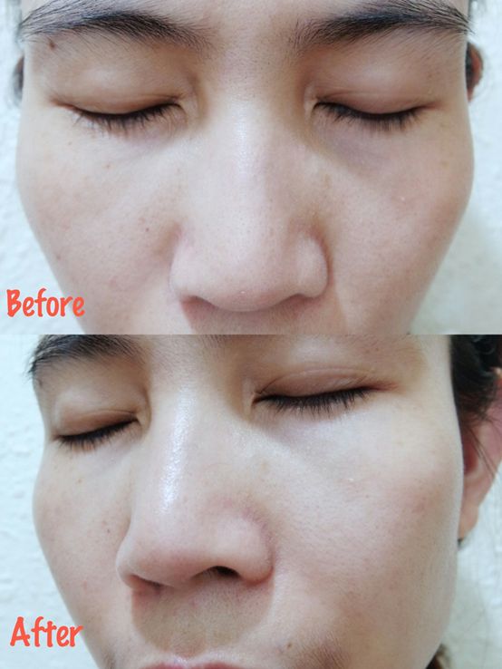 Derma彈力賦活霜