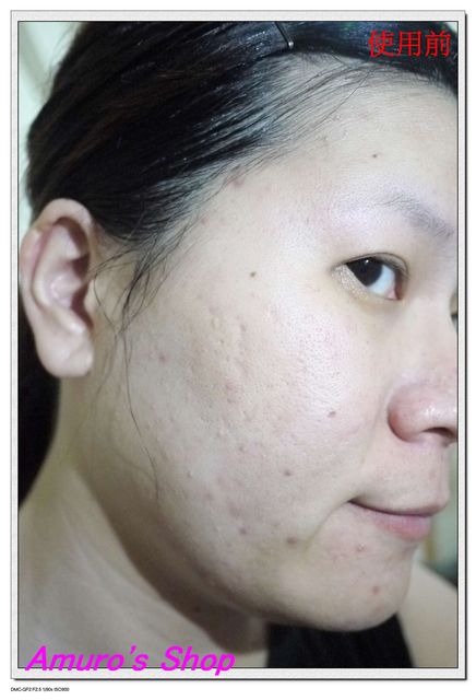 御泥坊去角質煥亮膜