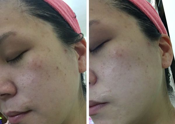 御泥坊去角質煥亮膜