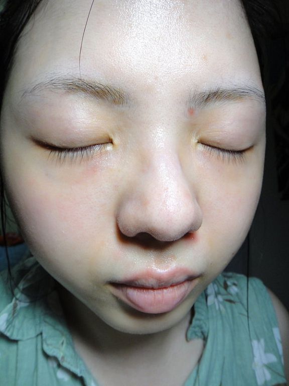 女人知己 試用 大隊 擦拭式 御泥坊 去角質 煥亮膜 清潔 棉 chialo