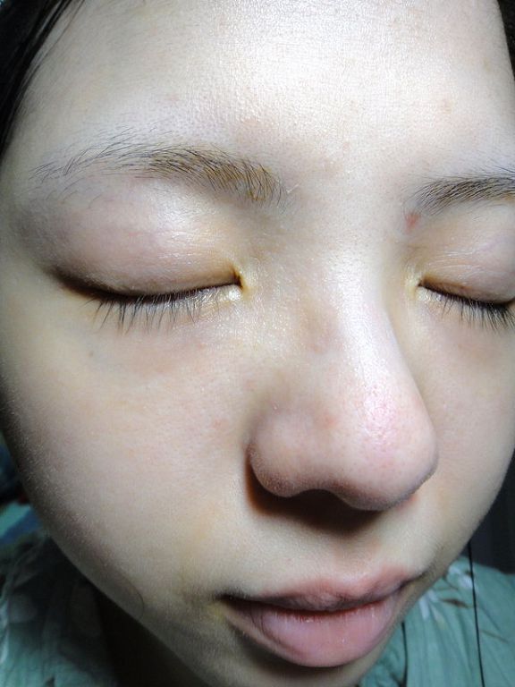 女人知己 試用 大隊 擦拭式 御泥坊 去角質 煥亮膜 清潔 棉 chialo