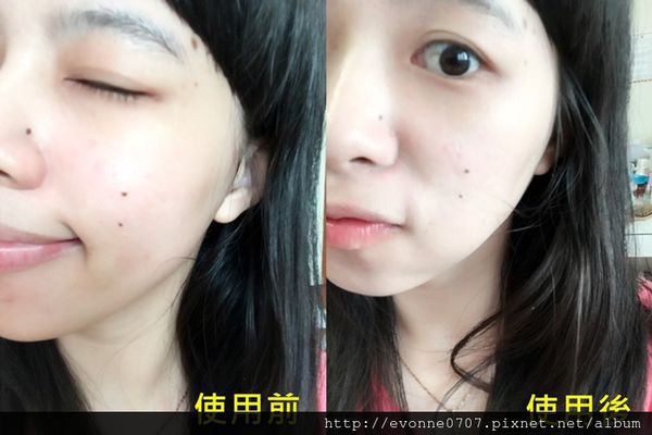 白夏菊舒護柔敏面膜