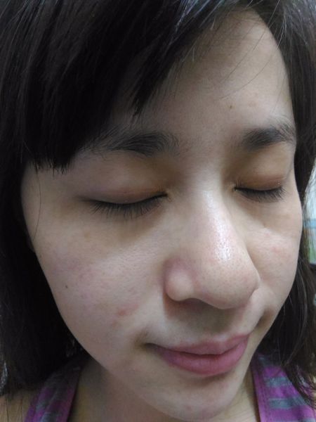 白夏菊舒護柔敏面膜