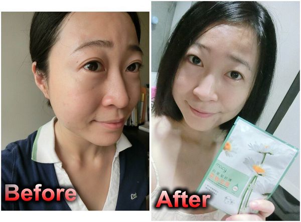 白夏菊舒護柔敏面膜