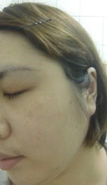 白夏菊舒護柔敏面膜