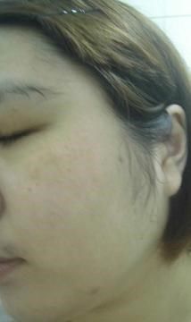 白夏菊舒護柔敏面膜