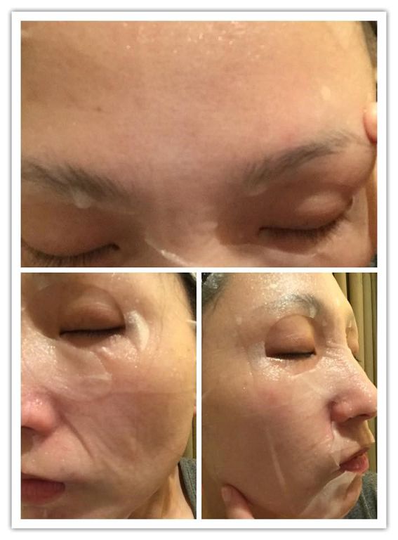 白夏菊舒護柔敏面膜