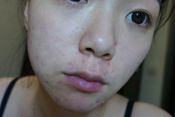 白夏菊舒護柔敏面膜