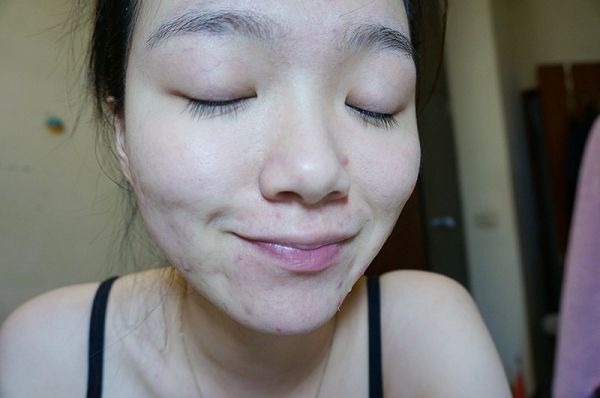 白夏菊舒護柔敏面膜