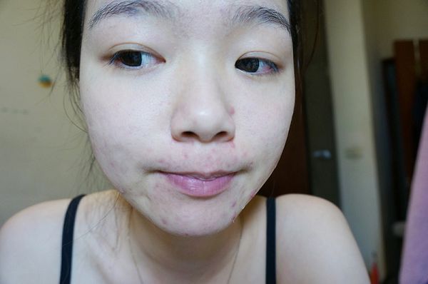 白夏菊舒護柔敏面膜