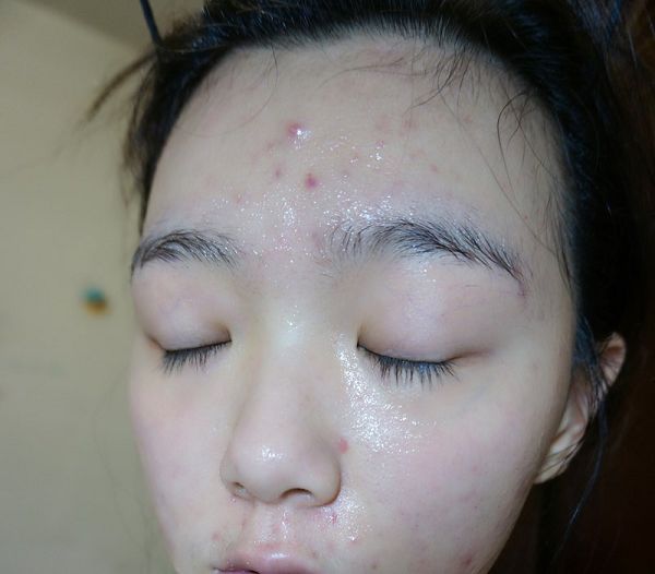 白夏菊舒護柔敏面膜