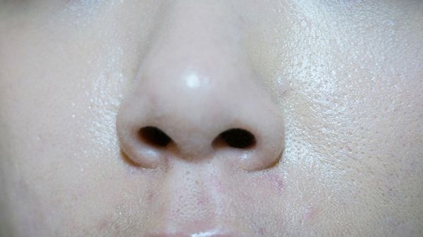 白夏菊舒護柔敏面膜