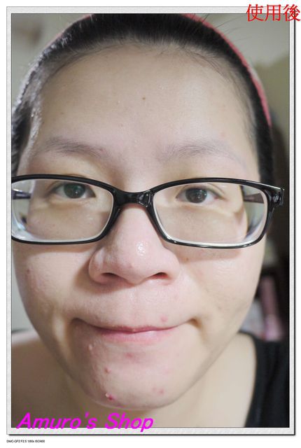  macy金縷梅爽膚淨荳面膜