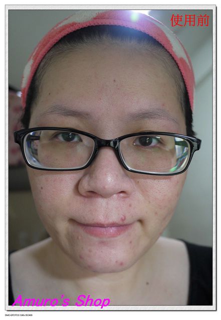  macy金縷梅爽膚淨荳面膜