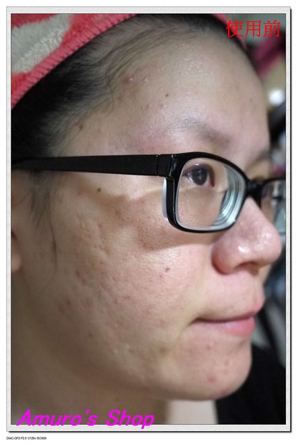  macy金縷梅爽膚淨荳面膜