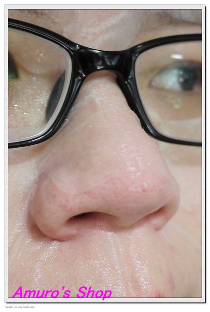  macy金縷梅爽膚淨荳面膜